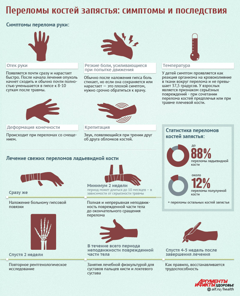 Переломы костей запястья: признаки и лечение | Инфографика ...